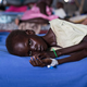 Seven-year-old Josephine John receives treatment for tuberculosis and malnutrition at International Medical Corps’ stabilization center at the Protection of Civilian site in Juba, South Sudan. (Crystal Wells/International Medical Corps)